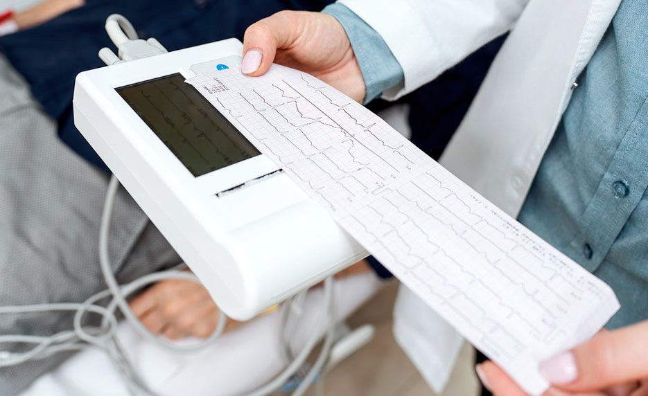 Medical professional holding a printed electrocardiogram (ECG) tracing from a portable monitor.